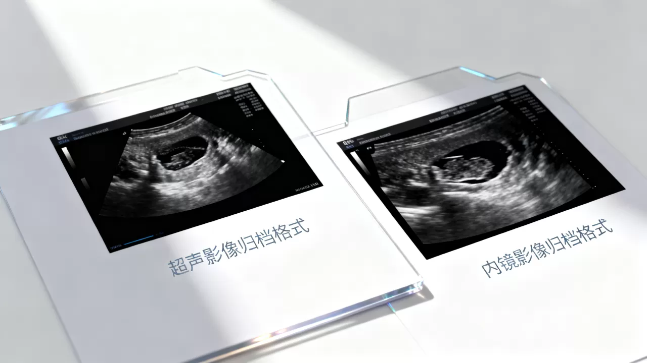 超声与内镜影像归档格式差异大吗，存储影响如何？
